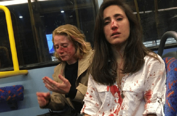 imagen de la pareja agredida en Londres